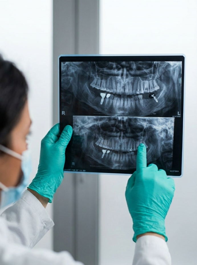 Digital X-Ray / OPG (Panoramic Radiography)